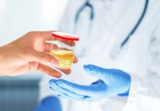 ECBU : Examen Cytobactériologique des urines